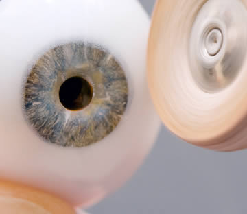 protesi-oculare-realizzazione-tecnicornea