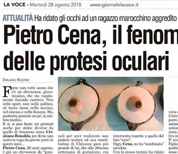 protesi-oculare-marocchino-sfigurato-acido